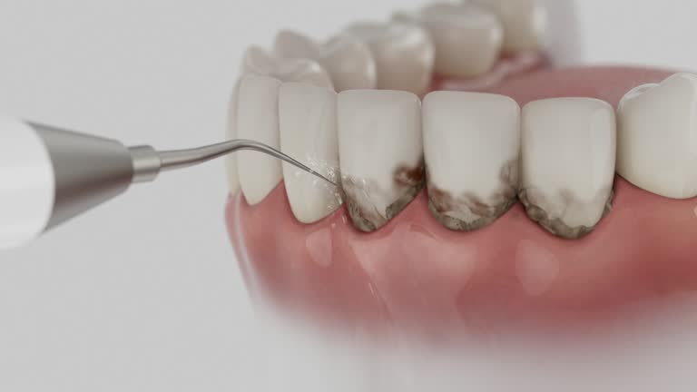 Reliable Teeth Cleaning And Checkup contractor in Henry County County, AL by Dentist Open Now
